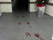 У Дніпровському районі Херсона поранено працівника лікарні під час обстрілу